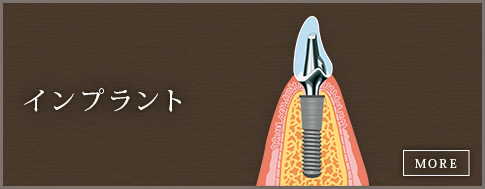 アキヤマ歯科医院 の写真