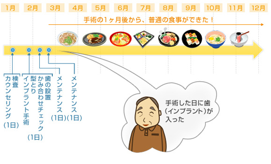 1日インプラント説明図　手術した日に入れ歯が入った