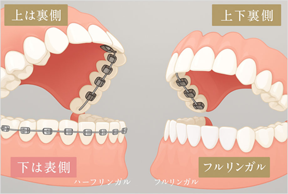 Ｆ－ＡＣＥ矯正歯科 の写真