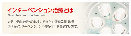 インターベンション治療とは