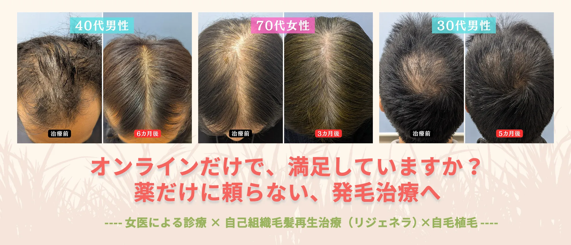 インフィニティヘアクリニック の写真
