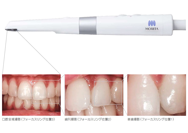 口腔内カメラの導入