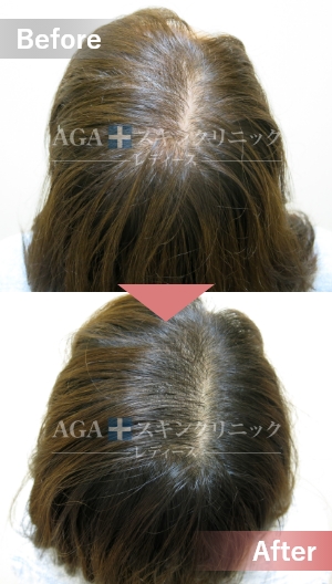 ＡＧＡスキンクリニック銀座レディース院 の写真
