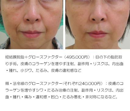 公式案内画像