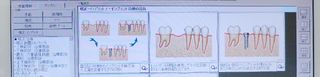 分かりやすく丁寧な説明